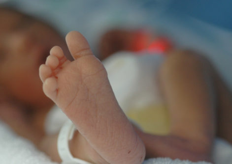 neonato pre termine