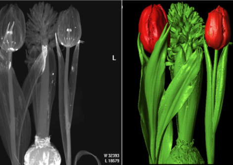 Radiografie per neonati