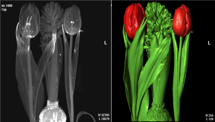 Radiografie per neonati